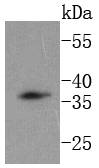 DKK1 Antibody