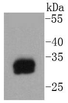 Mast Cell Tryptase Antibody
