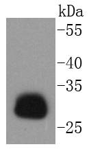 HLA-DR Antibody