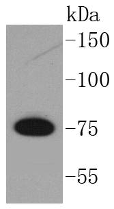 GARS Antibody