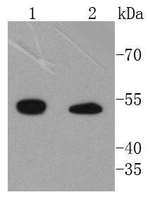 Integrin linked ILK Antibody