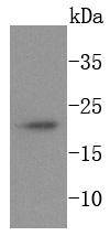 Ferritin Antibody