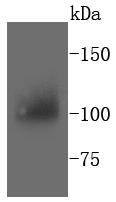 PYK2 Antibody