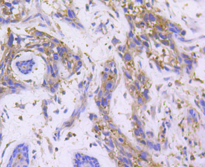RALBP1 Antibody