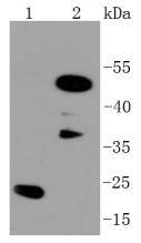 C/EBP Beta Antibody