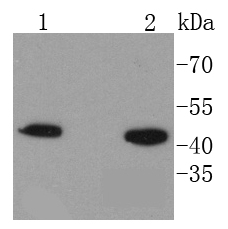 HMBS Antibody