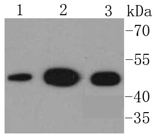 NSE Antibody