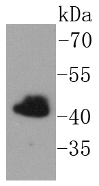 FNTB Antibody