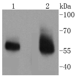 IRAKM Antibody