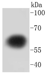 Tyrosine Hydroxylase Antibody