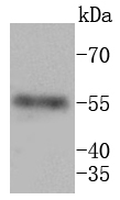 MMP11 Antibody