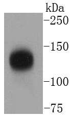 TACC3 Antibody