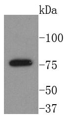 BTK Antibody