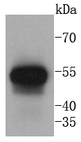 Cytokeratin 13 Antibody