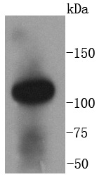 Angiotensin Converting Enzyme 2 Antibody