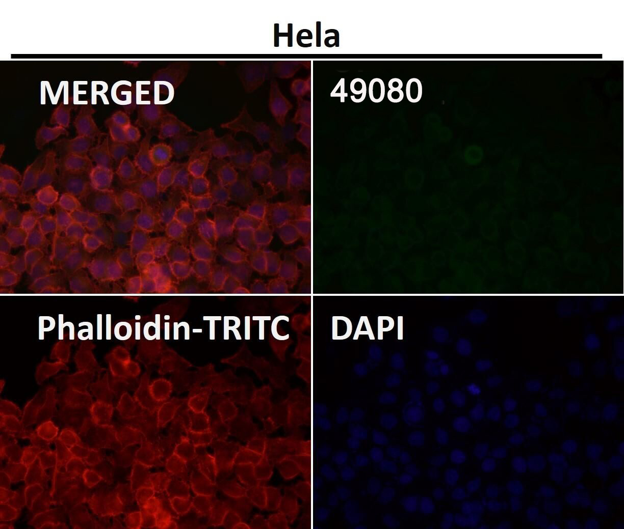 CCR2 Antibody