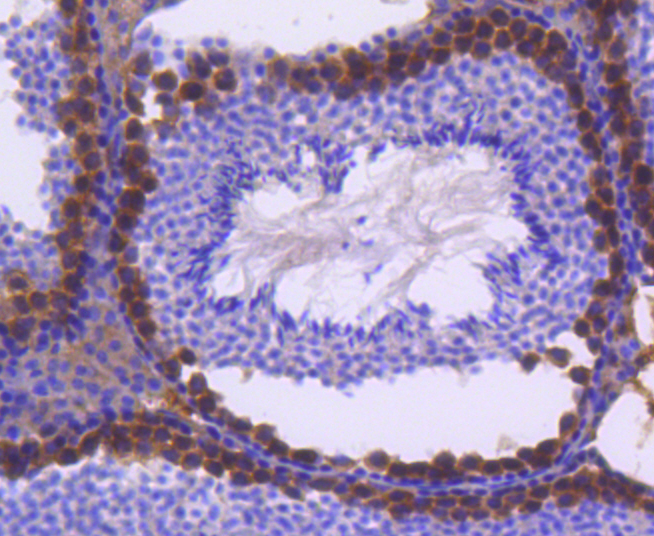 FANCD2 Antibody