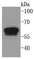 Cytokeratin 6 Antibody