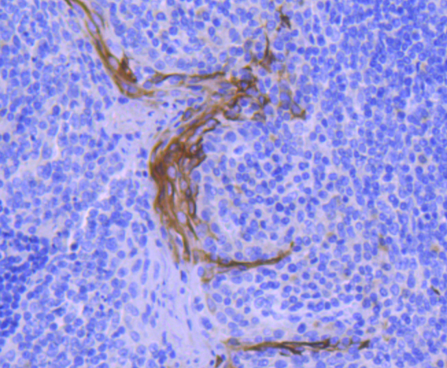 Cytokeratin 4 Antibody