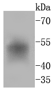 FosB Antibody