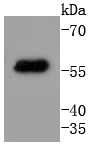 Cytokeratin 4 Antibody