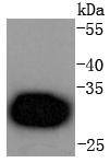 Cdk4 Antibody