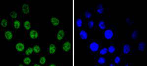 Cyclin E1 Antibody