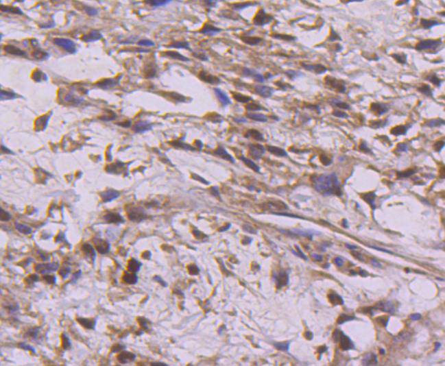 Cyclin E2 Antibody