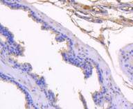 Prostate Specific Antigen Antibody
