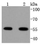 ATF4 Antibody