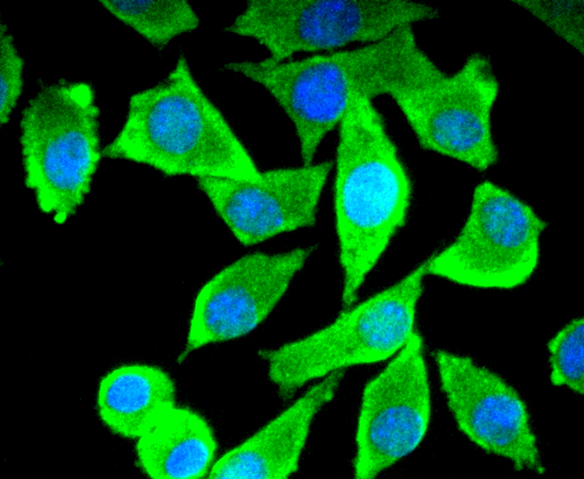 Tau Antibody
