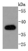 AMPK beta 1 Antibody