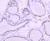 PAX8 Antibody