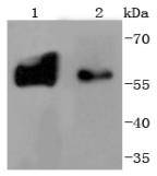Tyrosine Hydroxylase Antibody