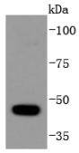 HDAC10 Antibody
