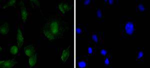SOX11 Antibody