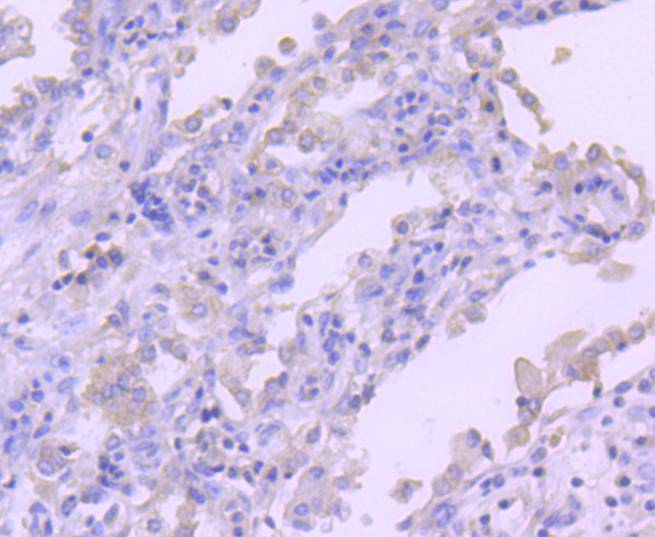 RON Antibody