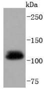 Ubiquitin-like modifier-activating enzyme 1 Antibody