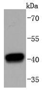 HDAC8 Antibody