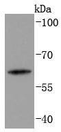 Cytokeratin 2e Antibody