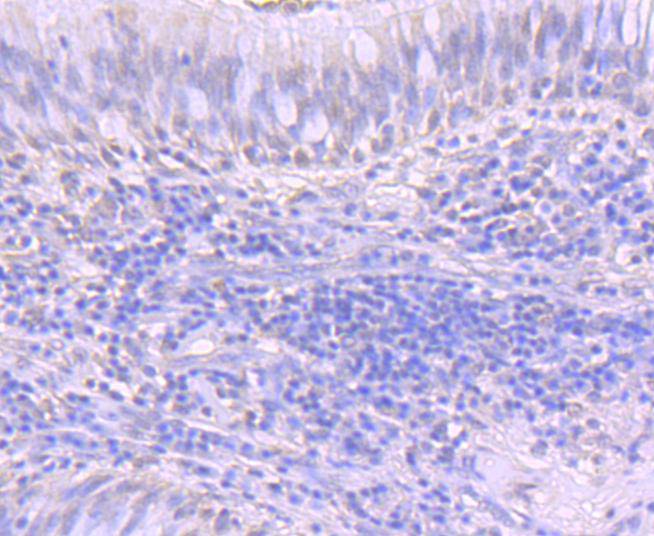 ATF1 Antibody