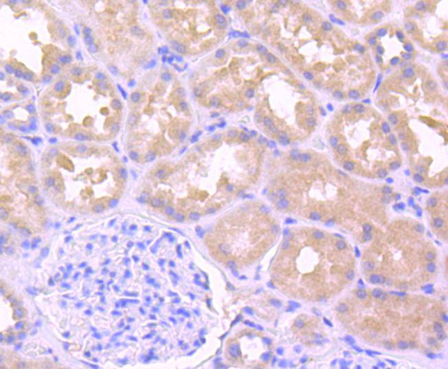 IL1 beta Antibody