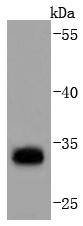 PD-L1 Antibody