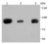STAT 5A+B Antibody