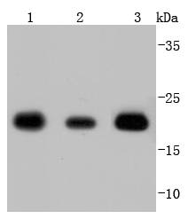 SOD2 Antibody