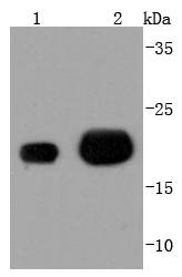 MGMT Antibody
