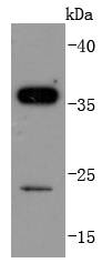 SIRT5 Antibody