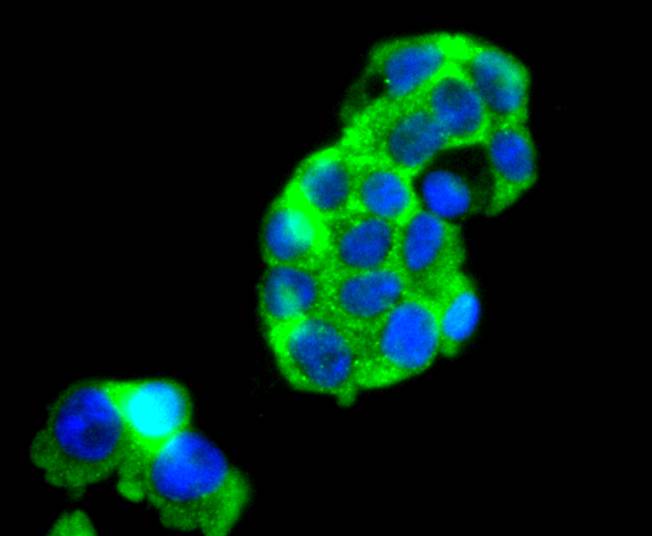 FOXO4 Antibody