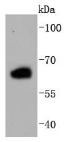 Estrogen Receptor beta Antibody