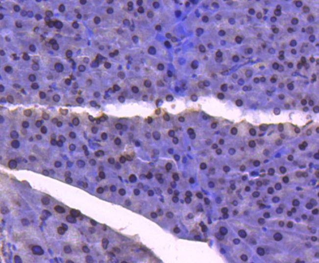 E2F1 Antibody